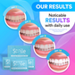 Advanced Teeth Whitening & Cleaning Strips (14 Treatments) DP2D