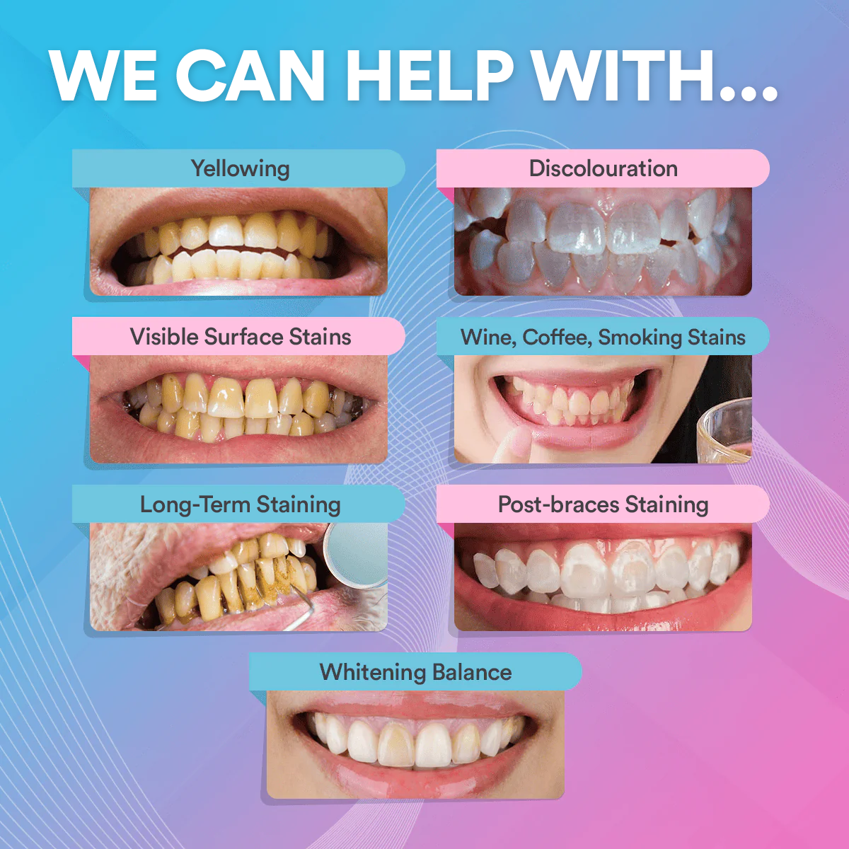 Teeth Cleaning & Whitening Strips (14 Treatments) DP6