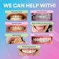 PAP+ Pro Teeth Whitening Powder DP4