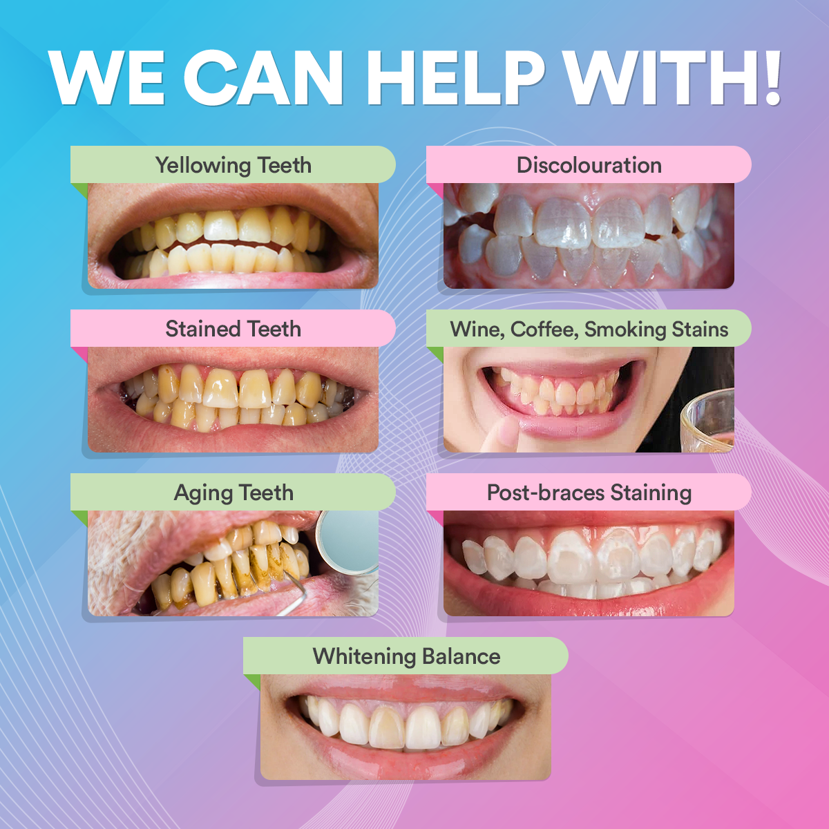 PAP+ Pro Teeth Whitening Powder DP4