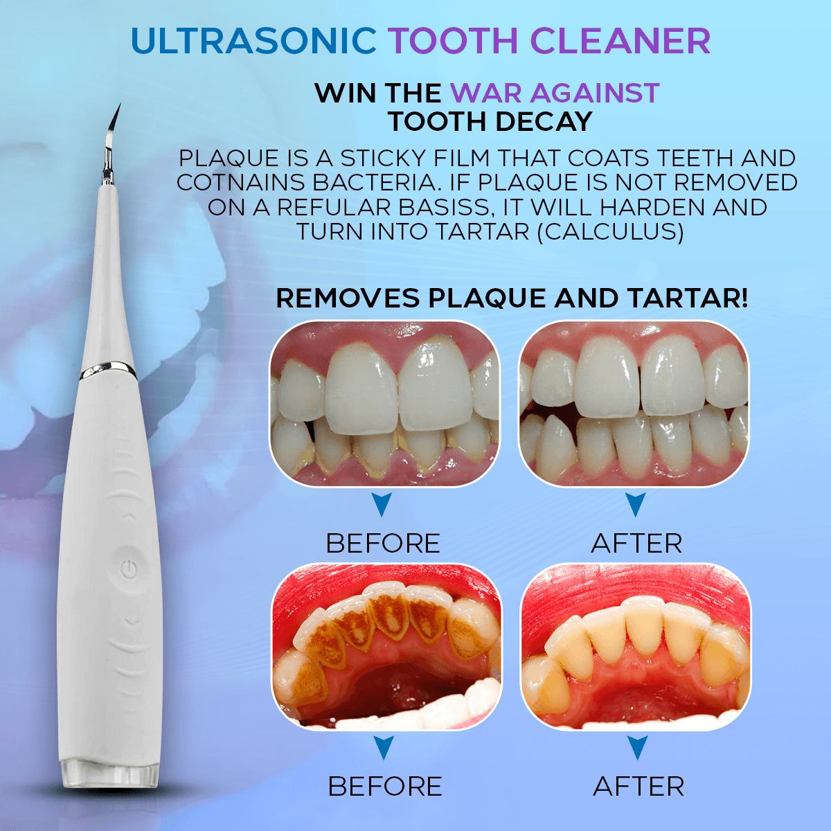 Ultrasonic Tooth Cleaner (TESTING)