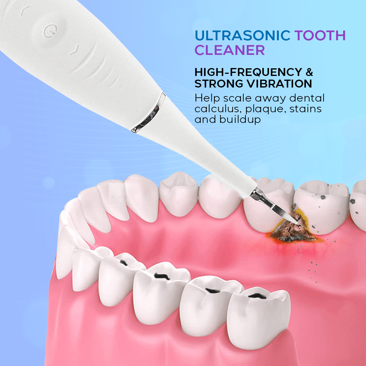 Ultrasonic Tooth Cleaner (TESTING)