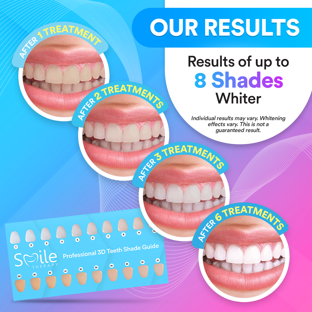 Advanced PAP+ At Home Teeth Whitening Kit DP2D