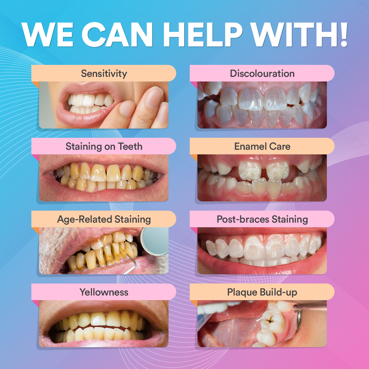 Advanced PAP+ At Home Teeth Whitening Kit DP2D