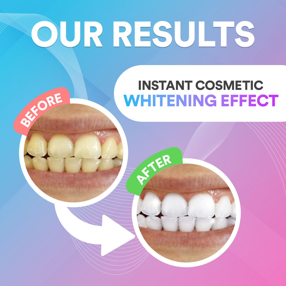 Teeth Whitening Pen DP10