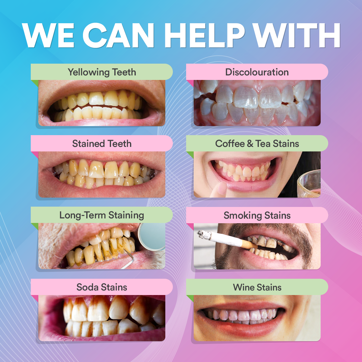 Teeth Whitening Pen DP9