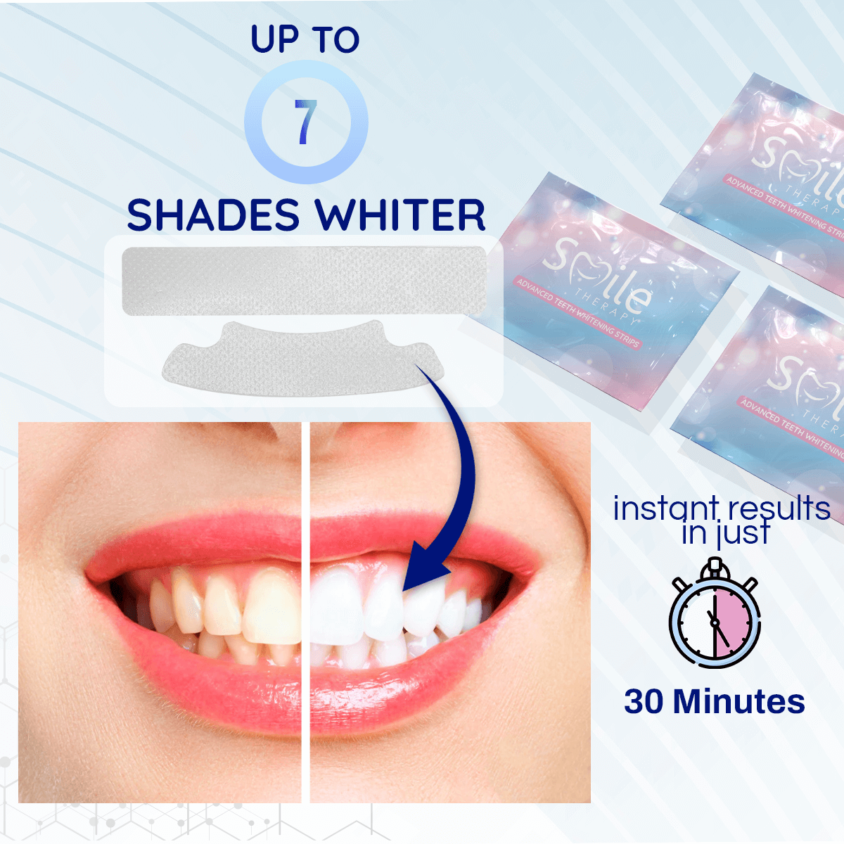 Teeth Cleaning & Whitening Strips (14 Treatments) DP10