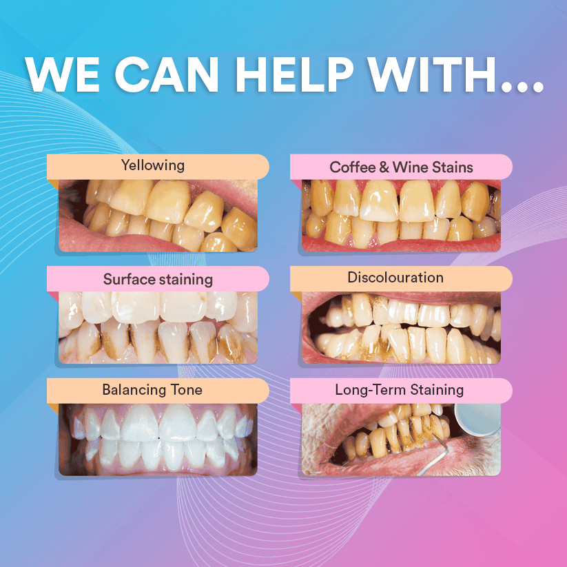 V34 Colour Corrector